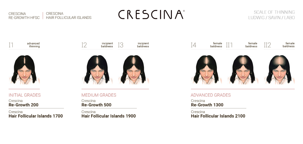 Шкала Людвига для оценки стадий выпадения волос (алопеции) у женщин